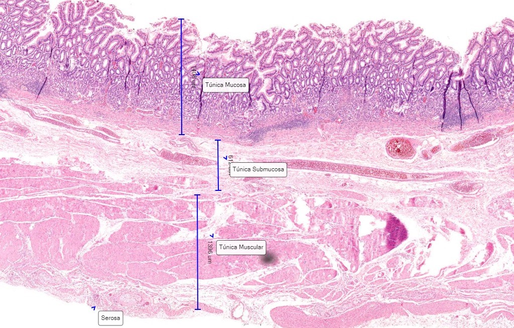 histología del fondo del estómago